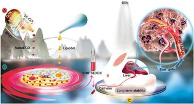 A Superstable Homogeneous Lipiodol-Nanoformulation to Overcome the Dilemma of Interventional Embolization Chemotherapy